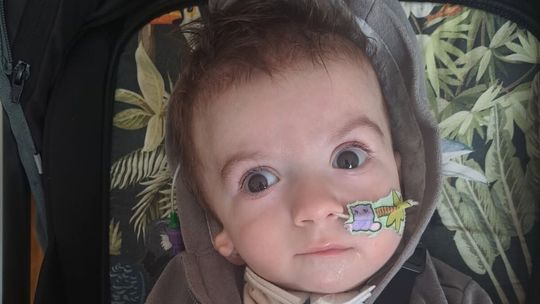 13-miesięczny Olek z Jastkowa przeszedł już pięć operacji. Potrzebne wsparcie