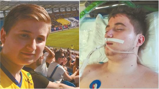 16-latek z Lublina w śpiączce po potrąceniu na przejściu. Mama ma tylko jedno marzenie