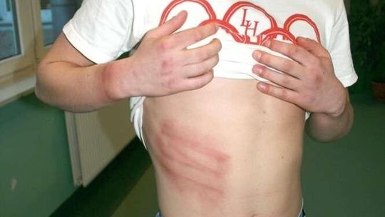 18-latek: Pobili mnie policjanci. Policja: Był agresywny, sam uderzył się w głowę