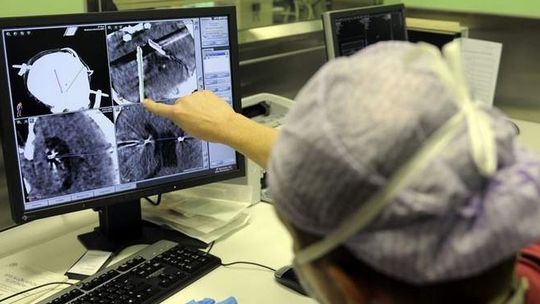 19-latka waży 151 kilogramów. Operacja mózgu ma być lekiem na jej otyłość [zdjęcia] 