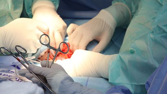 20-letni Artur zmarł po rutynowej operacji. Wyrok na lekarzy z Lublina
