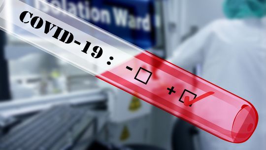 51 kolejnych zakażeń koronawirusem w Polsce. Jedno na Lubelszczyźnie