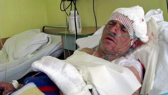 54-latek z Bieszczad przeżył atak niedźwiedzia