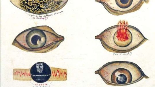 AB/ramowi/CE. Wystawa prac z archiwum Szpitala Neuropsychiatrycznego