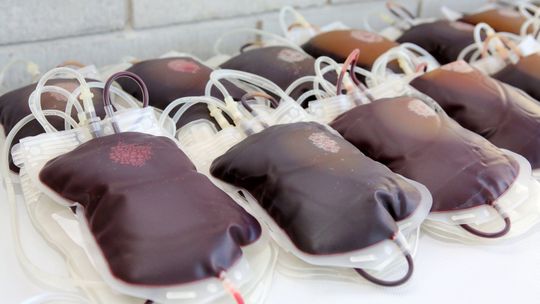 Bezpłatne warsztaty dla chorych na nowotwory krwi i szpiku