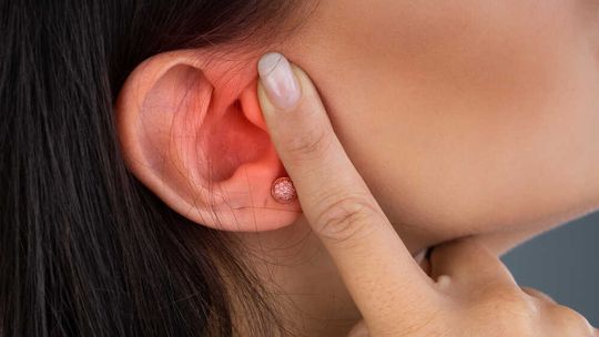 Ból ucha nie wybiera godziny – jak szybko zareagować, gdy pojawi się niespodziewanie?