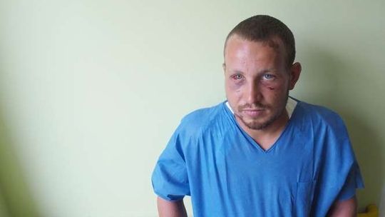 Brutalne pobicie w Lublinie. Zebrali pieniądze w kilkanaście godzin!