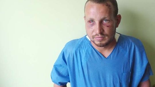 Brutalny atak na kolejnego Ukraińca w Lublinie. Usłyszał: "Po coś tu przyjechał się rządzić?"