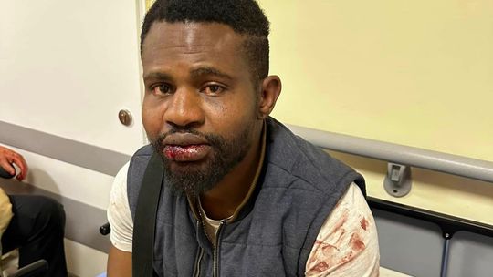 Brutalny atak w Lublinie. Bili, kopali, skakali po głowie "Skoro jest czarny..."