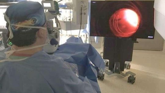 Chirurgia 3D. W Lublinie jedna z pierwszych takich operacji w Polsce