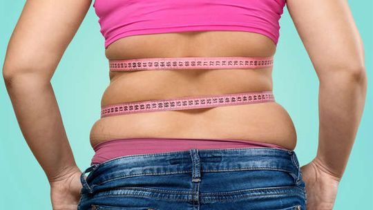 Chirurgiczne leczenie otyłości – wymysł czy konieczność?