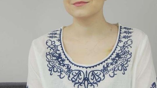 "Chorowanie na raka nie jest takie straszne. Chcemy normalnie żyć"