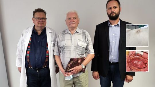 Cichy zabójca w brzuchu, przez którego pacjent może umrzeć w kilka minut. Lekarze wykryli 872 przypadki