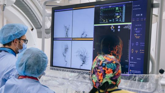 Coraz więcej młodych osób po udarze. Lublin znów w czołówce leczenia