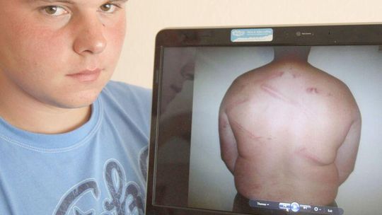 Czy policjanci pobili Mateusza? Śledztwo umorzone z braku dowodów