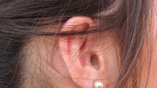 Darmowe badania słuchu w Zamościu