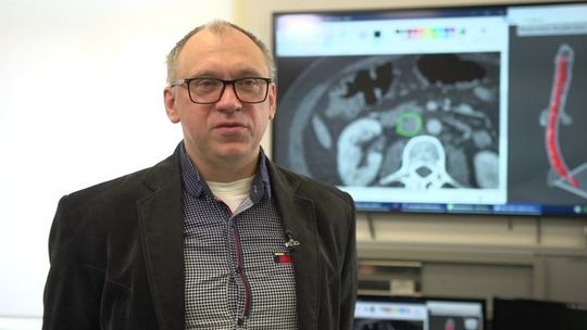 Druk 3D pomaga zaplanować operacje. Powstał trójwymiarowy model żyły ze zmianami nowotworowymi