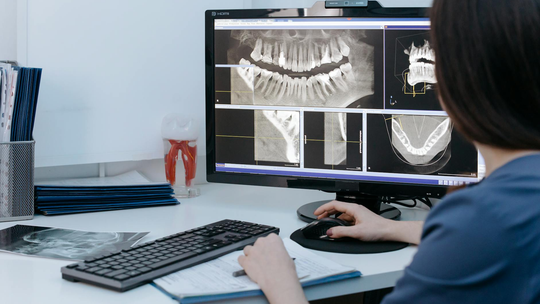 Główne zalety diagnostyki RTG w stomatologii