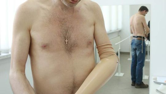 Granat wybuchł mu w dłoni. Bogdanka ufundowała protezę bojownikowi z Majdanu