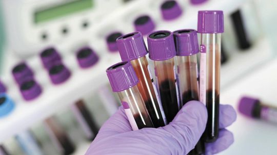 Groźna choroba, o której mało kto wie. Demoluje wątrobę