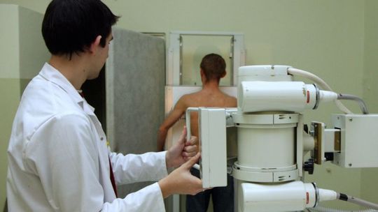 Gruźlica atakuje. Zmarło już dwa razy więcej chorych niż rok temu