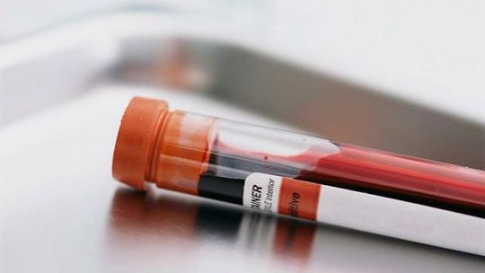 Jowita walczy o życie. Pomóż jej, oddaj krew