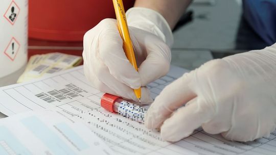 Każdy pracownik będzie upoważniony do bezpłatnego testu