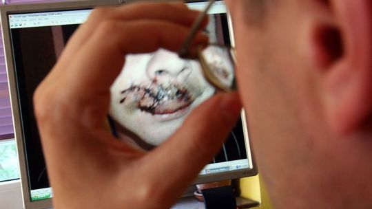 Kibic ze zmasakrowaną twarzą. Czy został trafiony policyjną kulą?