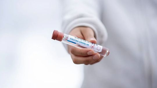 Komisja Europejska przedstawiła strategię w sprawie szczepionki przeciw COVID-19