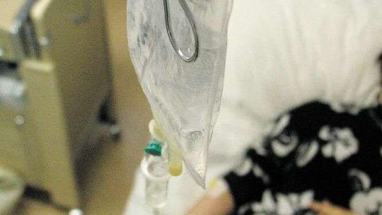 Kontrowersyjna metoda leczenia miażdżycy. Lekarze ostrzegają, jest pierwszy wyrok