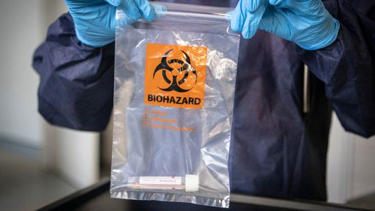 Koronawirus. Jest prototyp polskiej szczepionki na SARS-CoV-2 