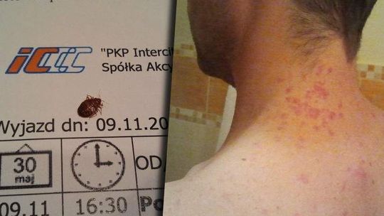 Koszmar w pociągu. Pluskwy dotkliwie pokąsały pasażera