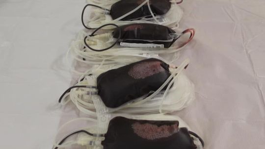 Krwiodawco, zgłoś się! Będą akcje w terenie