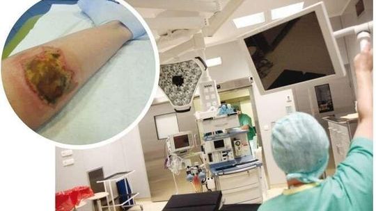 Leczyli nos, poparzyli nogę. "Zostałam trwale oszpecona w szpitalu w Lublinie"