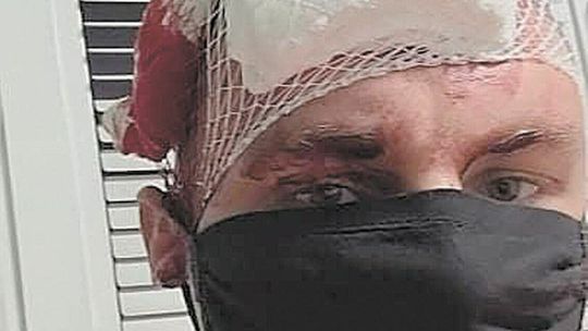 Lider zespołu disco polo stanął w obronie obsługi lokalu. Został zaatakowany i ma pękniętą czaszkę