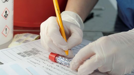 Lubelskie. Interweniuje Rzecznik Praw Pacjenta, bo ludzie za długo czekali na skierowanie na test na Covid-19