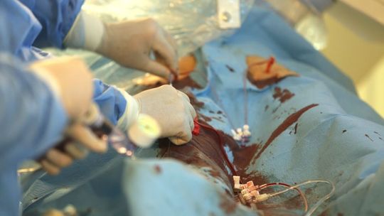 Lubelskie. Pacjentka po operacji została z chustą w brzuchu