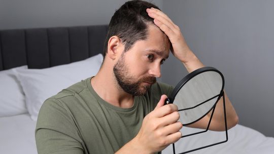 Łysienie a samoocena – jak utrata włosów wpływa na pewność siebie mężczyzn?