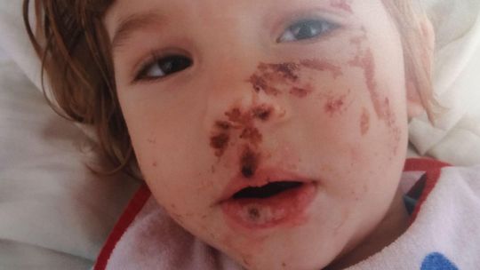 Mała Julia aż piszczy z bólu. Szansą dla niej jest leczenie w Niemczech