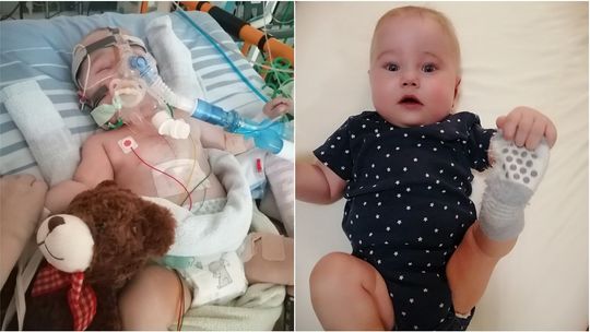 Mały Marcinek z Anusina walczy o życie w klinice w Niemczech. Rodzice zbierają na leczenie