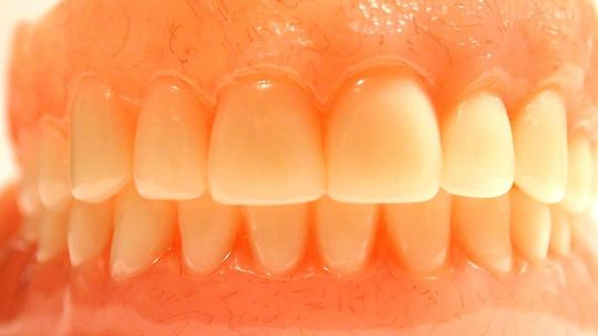 Mąż ukradł żonie protezę zębową