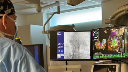 Na arytmię serca impulsy elektryczne. Tylko jeden szpital w regionie tak leczy 