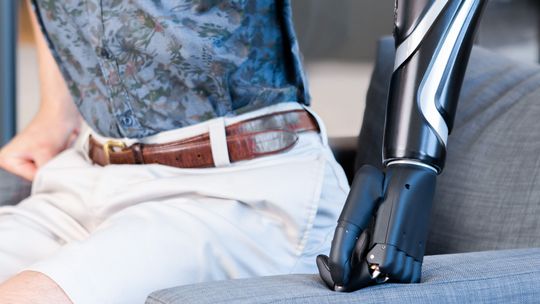 Na Ukrainie stracił rękę i nogę. Żołnierz nowoczesne protezy otrzymał w lubelskim szpitalu