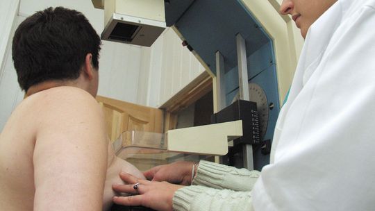 Nadzieja na normalne życie, bez strachu o przerzuty. Innowacyjne leki na raka piersi będą refundowane
