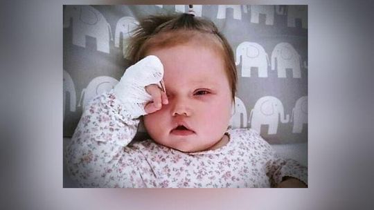 Nagle małej Marysi zaczęły migotać oczka. Dziewczynka z Lublina potrzebuje pomocy