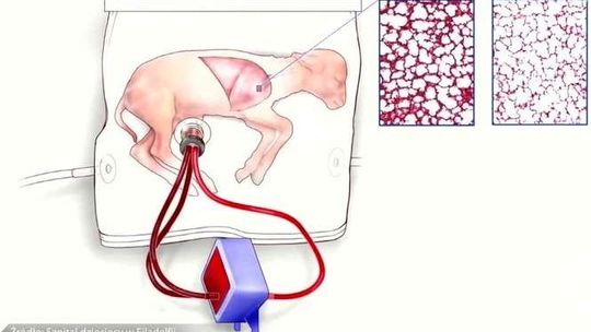 Naukowcy stworzyli sztuczną macicę. Urządzenie przetestowano na owcach