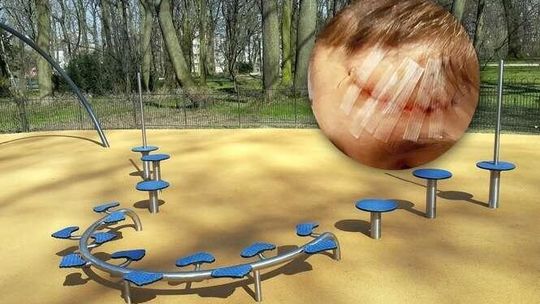 Niebezpieczny plac zabaw w Ogrodzie Saskim? "Syn trafił do szpitala"