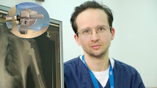 Niesamowita operacja w szpitalu w Lublinie. Implant prosto z drukarki