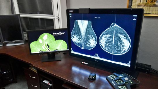 Nowoczesny mammograf w Wojewódzkim Ośrodku Medycyny Pracy już pracuje