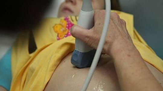 Nowy projekt opieki nad kobietami w ciąży. Które szpitale mogą wziąć udział?